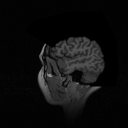 MRI Brain Original Slices