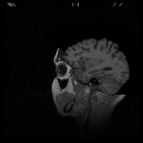MRI Brain My Slices
