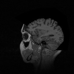 MRI Brain Original Slices