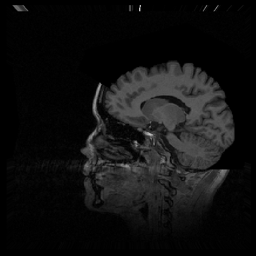 MRI Brain My Slices